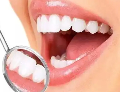 哪些方法可以美白牙齿